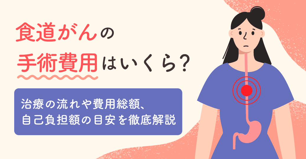 食道がんの手術費用はいくら?治療の流れや費用総額、自己負担額の目安を徹底解説